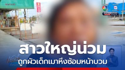 สาวใหญ่ถูกผัวรุ่นหลานซ้อมน่วมทั้งตัว จ.อุดรธานี