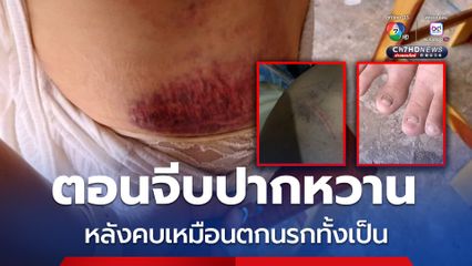 สาวสุดช้ำ แฟนหนุ่มที่เคยปากหวาน หลังคบไป 5 วันกลับออกลาย ทำร้ายจนตัวช้ำ มีดกรีด ไฟลน จับลากจนเล็บหลุด