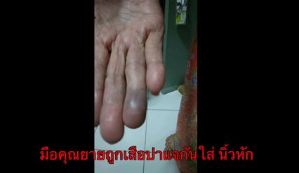 พี่บุกทำร้ายน้องชายแท้ ๆ ยายเข้าห้ามถูกปาแจกันใส่นิ้วหัก อ้างแค้นตอนเด็กถูกเลี้ยงมาไม่ดี