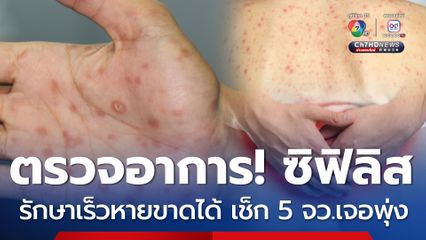 ตรวจอาการ! ซิฟิลิส รักษาเร็ว หายขาดได้ เช็ก 5 จังหวัด เจอพุ่ง