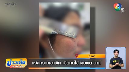 แจ้งความเอาผิด เมียคนไข้ ตบพยาบาล
