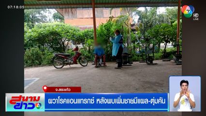 สระแก้วผวา โรคแอนแทรกซ์ หลังพบเพิ่มชายมีแผล-ตุ่มคัน