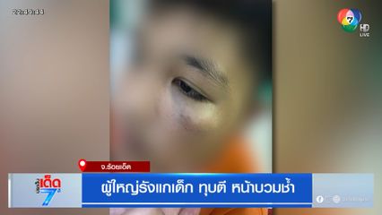 ผู้ใหญ่รังแกเด็ก ทุบตี หน้าบวมช้ำ