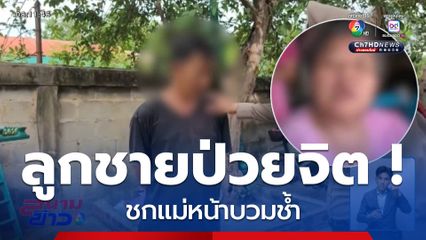 แม่ผวา ! ลูกชายป่วยจิตชกหน้าบวมช้ำ