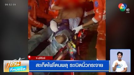 สะเก็ดไฟโดนพลุ ระเบิดนิ้วกระจาย
