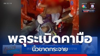 สะเก็ดไฟโดนพลุ ระเบิดนิ้วกระจาย