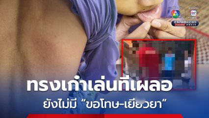 ด.ช.15 ปี ถูกเตะสลบคาโรงเรียน ครอบครัวร้องความเป็นธรรม ยันยังไม่เคยได้รับคำขอโทษ-เงินเยียวยา