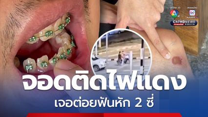 หนุ่มเจอแจ็กพอต! จอดมอเตอร์ไซค์ติดไฟแดง เจอชกหน้า ฟันหัก 2 ซี่