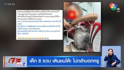 เด็ก 8 ขวบ เดินชนโต๊ะ ไม่กล้าบอกครู
