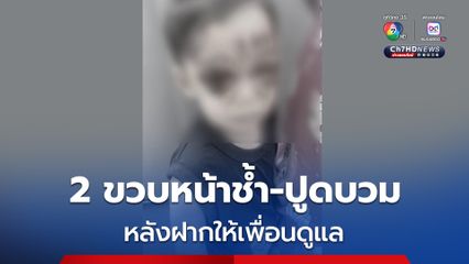 แม่ช็อก! ลูกชาย 2 ขวบ หน้าช้ำ ปูดบวม หลังฝากให้เพื่อนดูแล อ้างลื่นน้ำยาล้างจานหกล้มเอง