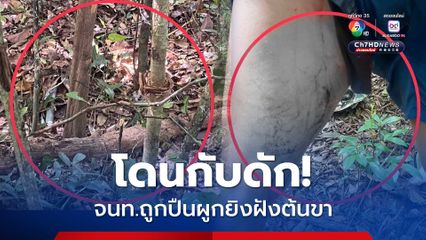 โดนกับดัก จนท.ถูกปืนผูกยิงฝังต้นขา