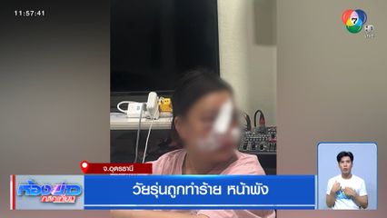 วัยรุ่นถูกทำร้าย หน้าพัง จ.อุดรธานี