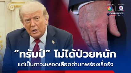 ทำเนียบขาวสยบข่าวลือเรื่อง “โดนัลด์ ทรัมป์” ป่วยหนัก เป็นเพียงอาการขาบวม-มือฟกช้ำจากเส้นเลือดขอด