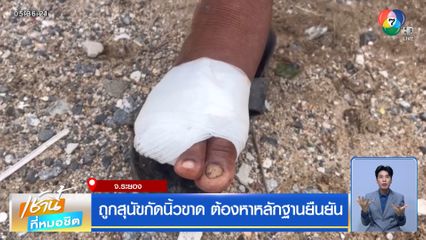 ถูกสุนัขกัดนิ้วขาด ต้องหาหลักฐานยืนยัน