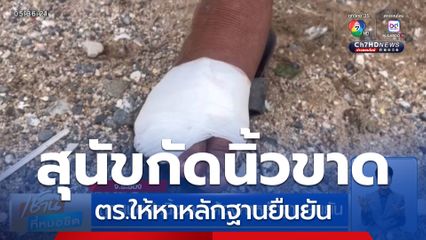 ถูกสุนัขกัดนิ้วขาด ต้องหาหลักฐานยืนยัน