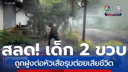 สลดใจ หนูน้อยอายุ 2 ขวบ 8 เดือน ถูกฝูงต่อหัวเสือรุมต่อยเสียชีวิต