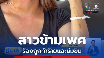 สาวข้ามเพศ ร้องถูกทำร้ายและข่มขืน