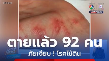 ภัยเงียบ ! โรคไข้ดิน ตายแล้ว 92 คน