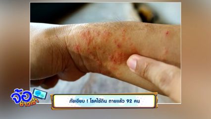 ภัยเงียบ ! โรคไข้ดิน ตายแล้ว 92 คน