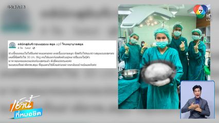 ผ่าตัด "ซีสต์รังไข่" น้ำหนัก 8 กก.
