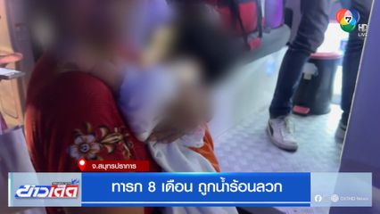 ทารก 8 เดือน ถูกน้ำร้อนลวก