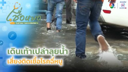 เชื่อหมอ : เดินเท้าเปล่าลุยน้ำ เสี่ยงติดเชื้อโรคฉี่หนู
