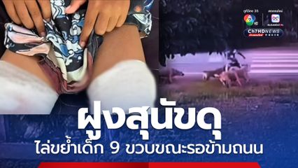 เด็ก 9 ขวบ วิ่งหนีตายข้ามถนน ถูกฝูงสุนัขดุไล่ขย้ำ บาดเจ็บ 