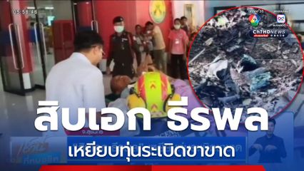 สิบเอก ธีรพล เหยียบทุ่นระเบิดขาขาด