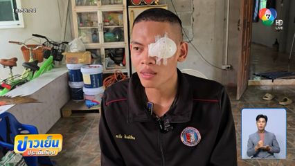 เยี่ยมให้กำลังใจทหารตาบอด