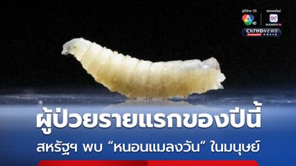 สหรัฐฯ พบผู้ป่วยจาก “หนอนแมลงวัน” รายแรกของปีนี้ ที่รัฐแมริแลนด์ 