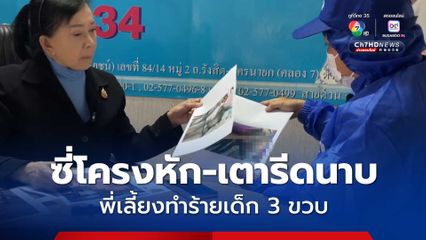 พี่เลี้ยงโหด! ทำร้ายเด้ก 3 ขวบ ซี่โครงหัก เตารีดนาบใบหน้า-ลำตัว