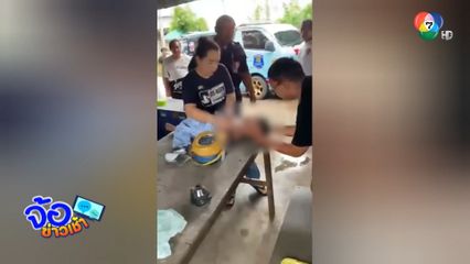 อุทาหรณ์ ! เด็กหญิง 2 ขวบ หัวทิ่มถังน้ำ อาการสาหัส