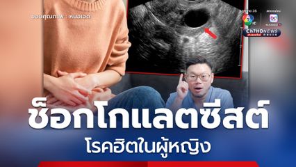 หมอเจดโพสต์เตือน ช็อกโกแลตซีสต์ โรคฮิตในผู้หญิง หลายคนเป็นแต่ไม่รู้ตัว