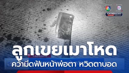 พ่อตาถูกมีดฟันหน้า ตาหวิดบอด