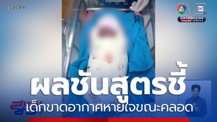 ผลชันสูตรชี้ เด็กขาดอากาศหายใจขณะคลอด