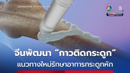 จีนเผยผลวิจัยใหม่ พัฒนา “กาวติดกระดูก” รักษาอาการกระดูกหัก