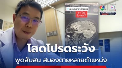 โสดโปรดระวัง สมองตายหลายตำแหน่ง ผลตรวจพบมะเร็งรังไข่