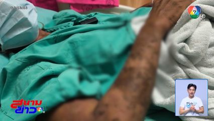 เชื่อหมอพื้นบ้านพ่นหมากพลู เชื้อโรคเริมลามทั้งตัว