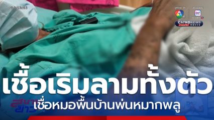 เชื่อหมอพื้นบ้านพ่นหมากพลู เชื้อโรคเริมลามทั้งตัว