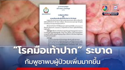 “โรคมือเท้าปาก” ระบาด กัมพูชาพบผู้ป่วยเพิ่มมากขึ้น