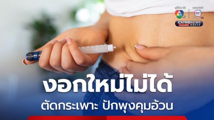 เพจดังเตือนผลจข้างเคียงร้ายแรง ตัดกระเพาะ-ปักพุงคุมหิว