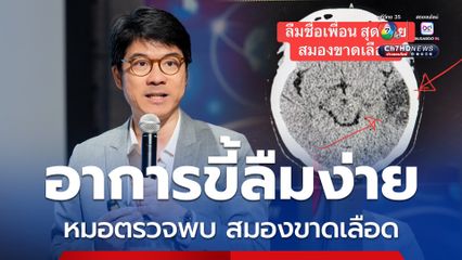 “หมอสุรัตน์” พบคนไข้ “ขี้ลืมง่าย” มีอาการสมองขาดเลือด เป็น “อัมพฤต” ได้