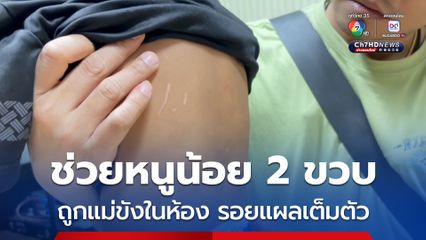 ช่วยหนูน้อย 2 ขวบ ถูกแม่ขังในห้อง รอยแผลเต็มตัว