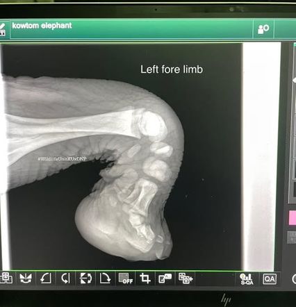 เริ่มกายภาพบำบัด ลูกช้าง “ข้าวต้ม” ใช้ขาได้นิดหน่อย