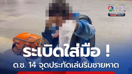 ระเบิดใส่มือ ด.ช. 14 จุดประทัดเล่นริมชายหาด