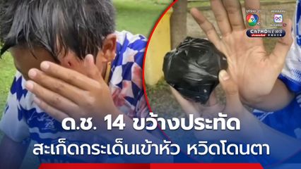 ด.ช. 14 ขว้างประทัด สะเก็ดกระเด็นเข้าหัว หวิดโดนตา