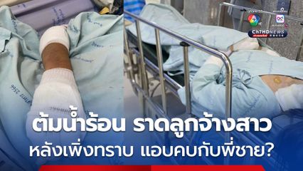 ลูกจ้างสาว ถูกลูกสาวนายจ้าง ต้มน้ำร้อนราดหัว คาดก่อเหตุเพราะเพิ่งทราบข่าวว่า ลูกจ้างสาวคนนี้ แอบคบหาพี่ชาย