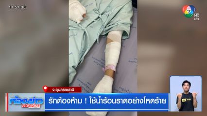 รักต้องห้าม ! ใช้น้ำร้อนราดอย่างโหดร้าย