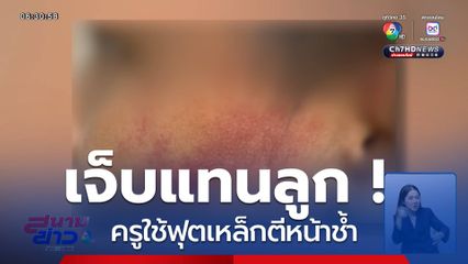 เจ็บแทนลูก ! ครูใช้ฟุตเหล็กตีหน้าช้ำ จ.ลำปาง