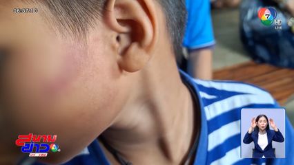 แม่เด็ก ไม่ถอนแจ้งความครูใช้ฟุตเหล็กตีลูก